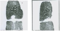 Altered Fingerprints: Burn Method