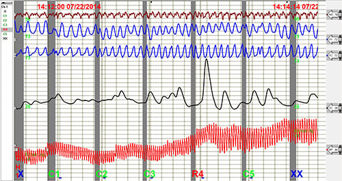 Polygraph Chart (Stock Image)