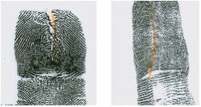 Altered Fingerprints: Vertical Cut or Slice