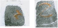 The intent of the z-pattern cut is to scar and distort the natural fingerprint into an unnatural pattern. As with the vertical cut or slice, individuals cut the fingertip; however, in this case they cut a z-shaped pattern.